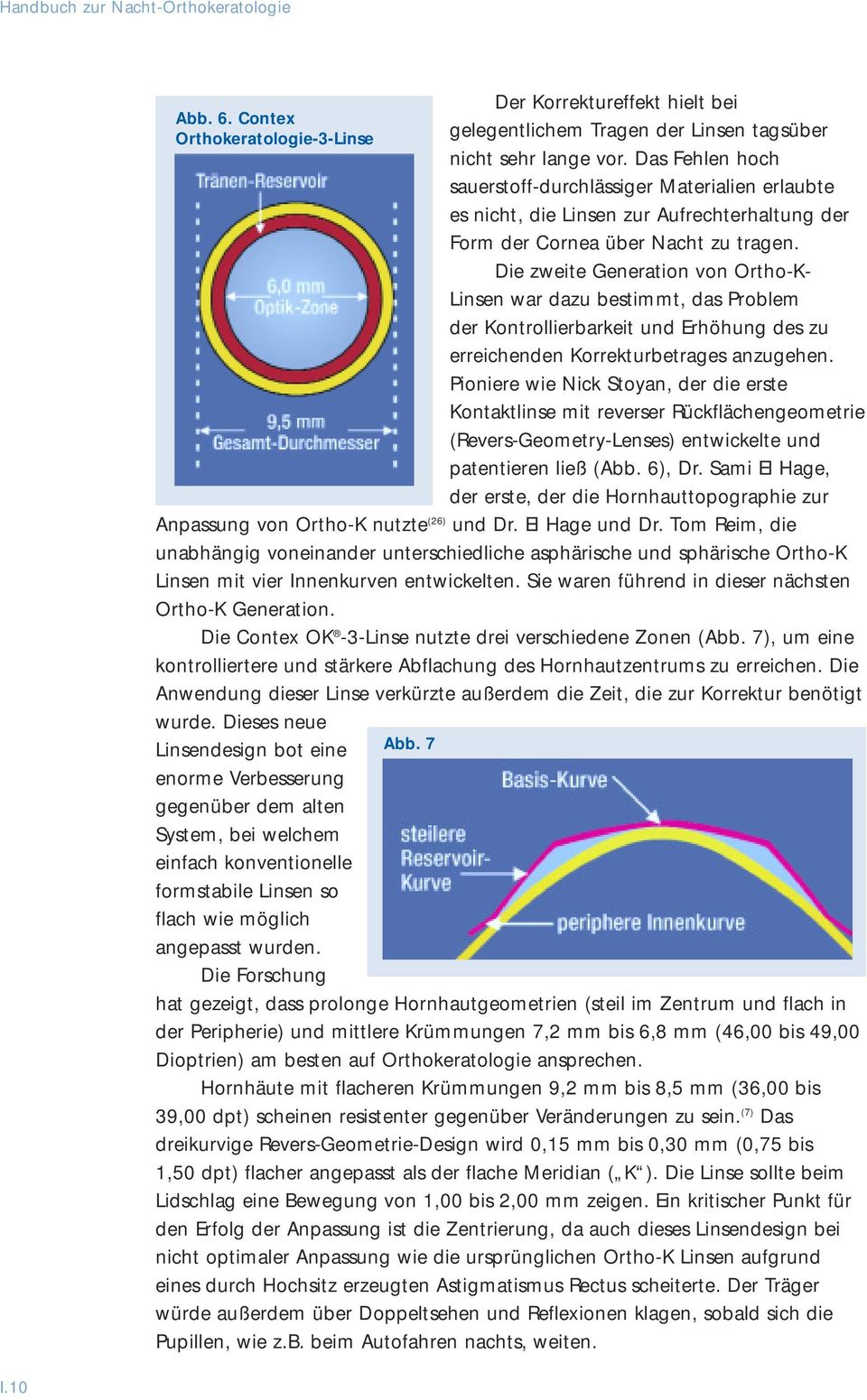 Die zweite Generation von Ortho-K- Linsen war dazu bestimmt, das Problem der Kontrollierbarkeit und Erhöhung des zu erreichenden Korrekturbetrages anzugehen.