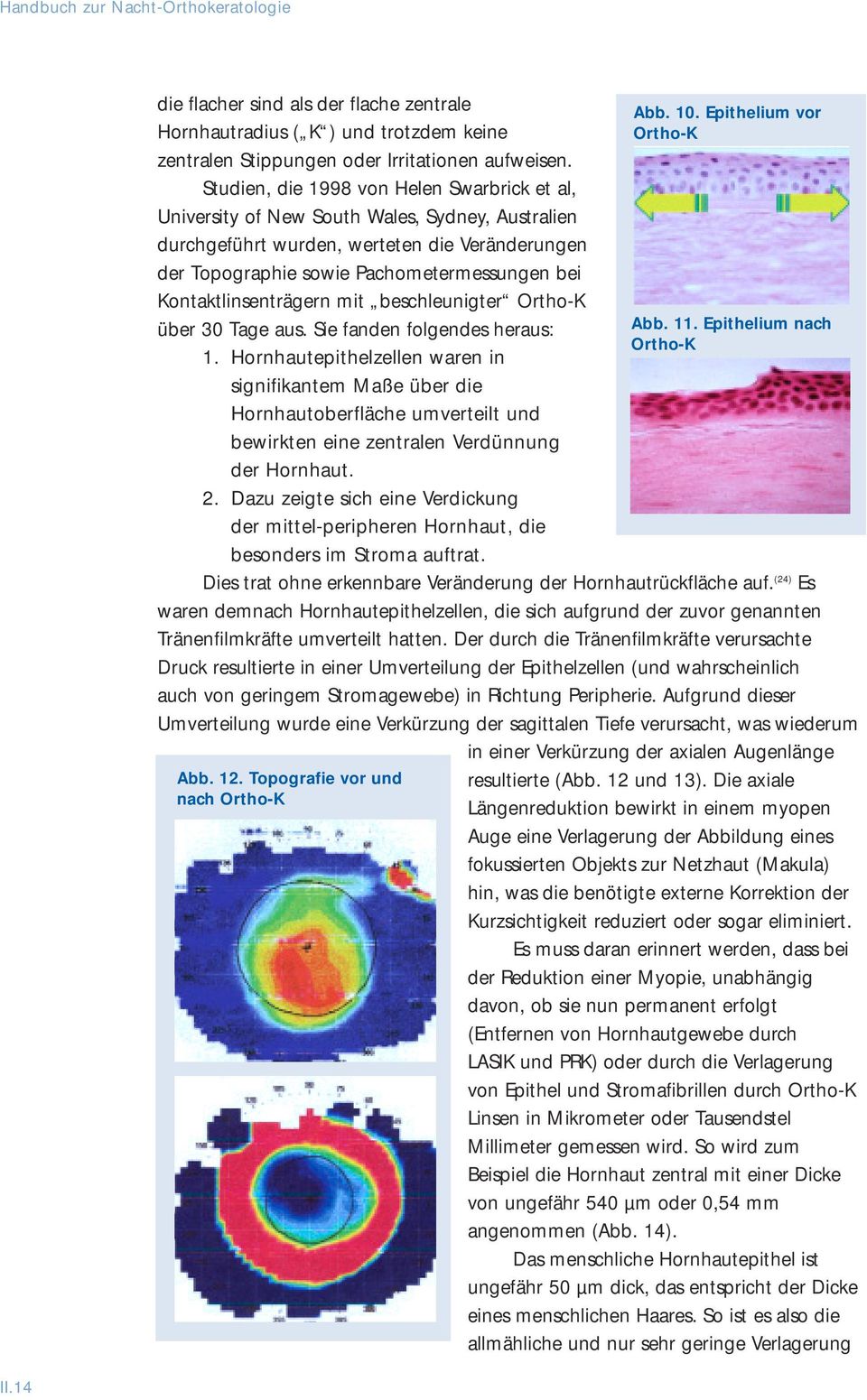 Kontaktlinsenträgern mit beschleunigter Ortho-K über 30 Tage aus. Sie fanden folgendes heraus: 1.