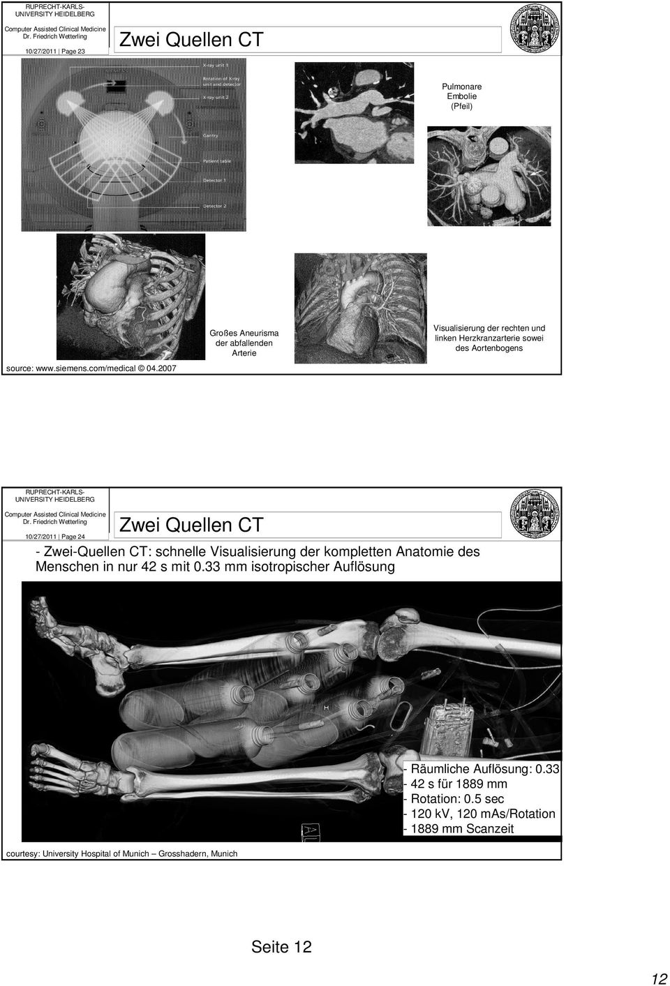 2007 RUPRECHT-KARLS 10/27/2011 Page 24 Zwei Quellen CT - Zwei-Quellen CT: schnelle Visualisierung der kompletten Anatomie des Menschen in nur 42 s