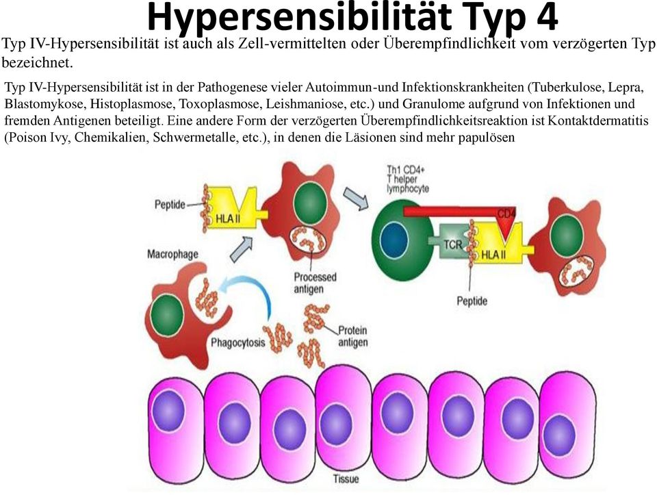 Histoplasmose, Toxoplasmose, Leishmaniose, etc.) und Granulome aufgrund von Infektionen und fremden Antigenen beteiligt.