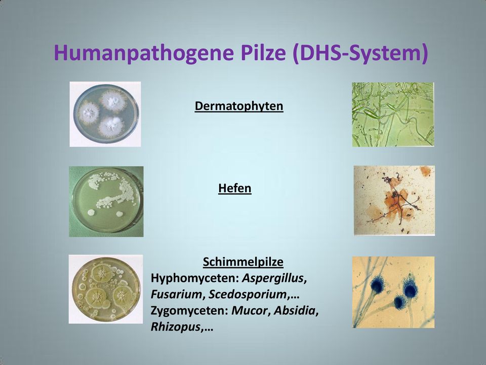 Hyphomyceten: Aspergillus, Fusarium,