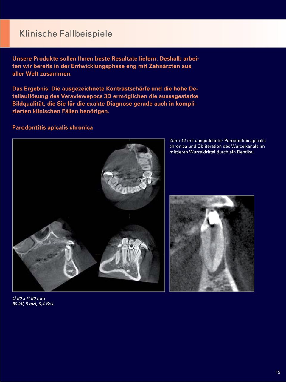 Das Ergebnis: Die ausgezeichnete Kontrastschärfe und die hohe Detailauflösung des Veraviewepocs 3D ermöglichen die aussagestarke Bildqualität, die Sie