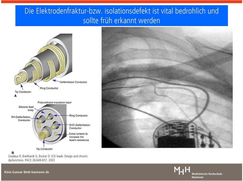 früh erkannt werden Gradaus R, Breithardt G,