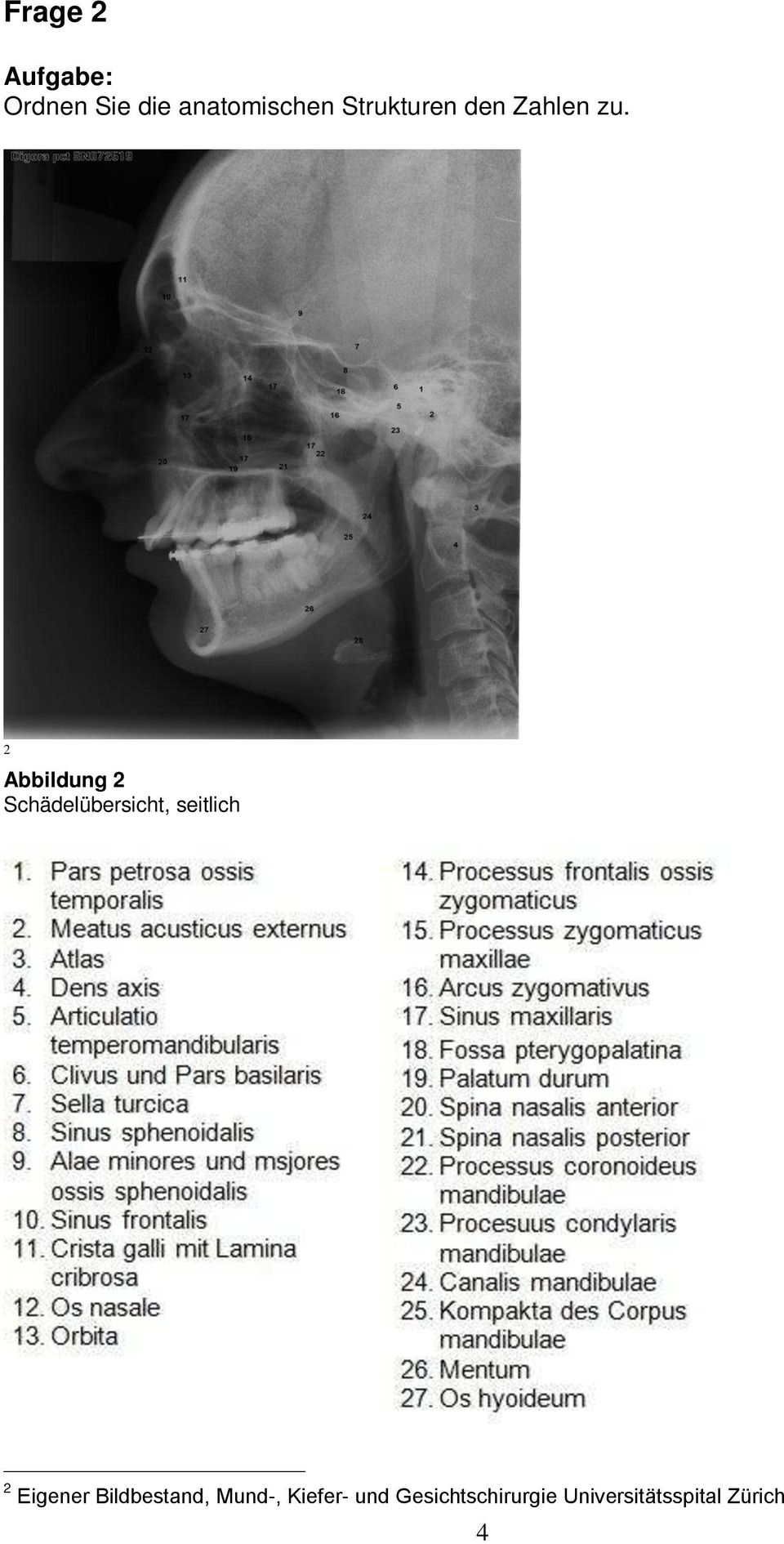 2 Abbildung 2 Schädelübersicht, seitlich 2