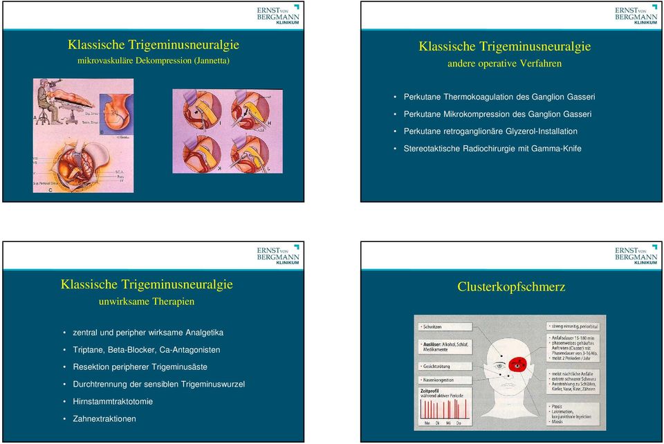 Stereotaktische Radiochirurgie mit Gamma-Knife Klassische Trigeminusneuralgie unwirksame Therapien Clusterkopfschmerz zentral und peripher wirksame