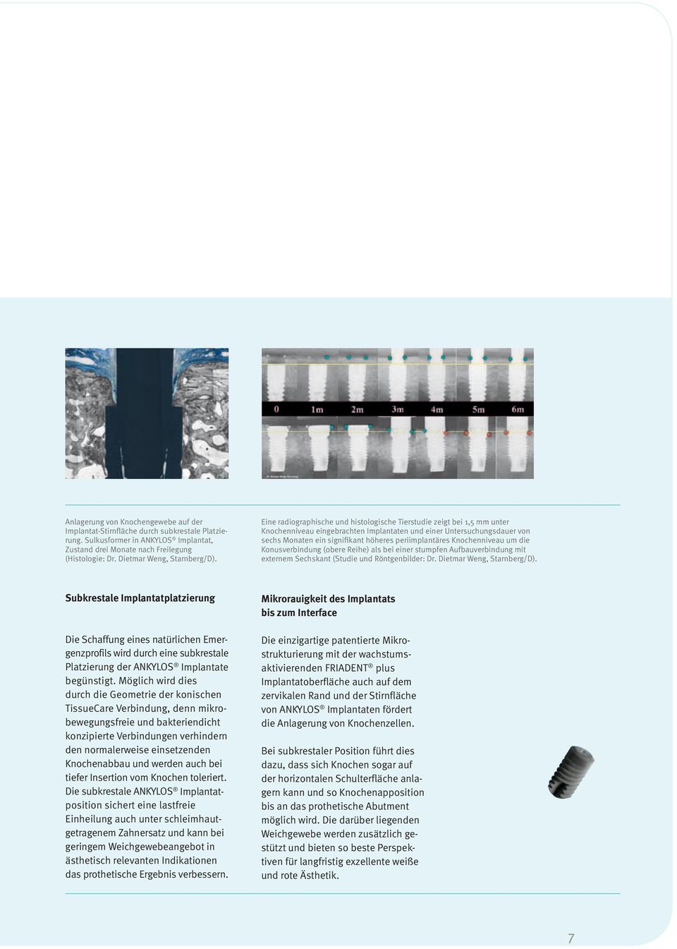 Eine radiographische und histologische Tierstudie zeigt bei 1,5 mm unter Knochenniveau eingebrachten Implantaten und einer Untersuchungsdauer von sechs Monaten ein signifikant höheres periimplantäres