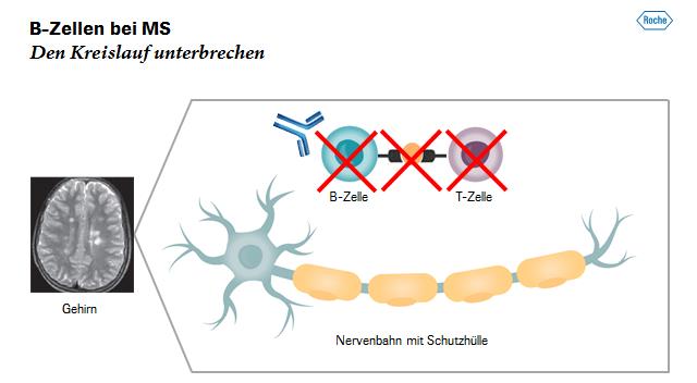 Ansprache Severin Schwan Seite 11/15 Bei jeder MS-Attacke passiert immer wieder dasselbe: Die fehlgeleitete B-Zelle trifft auf die Nervenschutzhülle, denkt, einen Eindringling vor sich zu haben, und