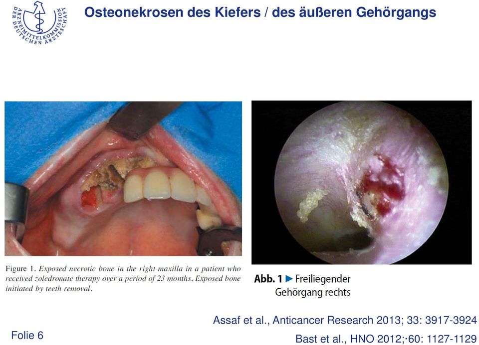 al., Anticancer Research 2013; 33: