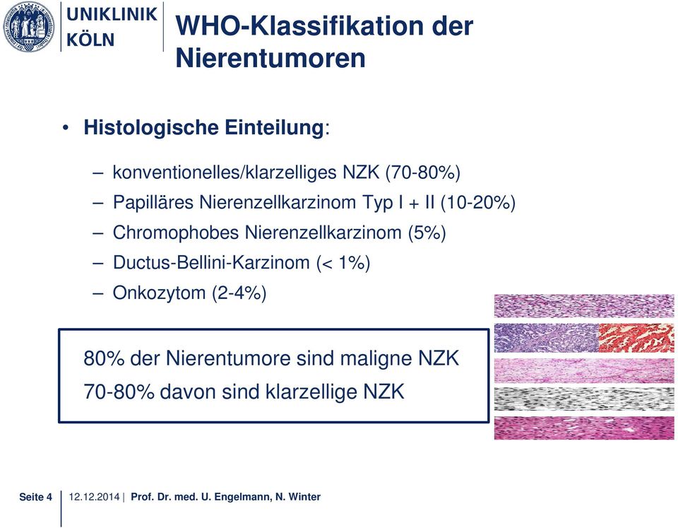 II (10-20%) Chromophobes Nierenzellkarzinom (5%) Ductus-Bellini-Karzinom (< 1%)