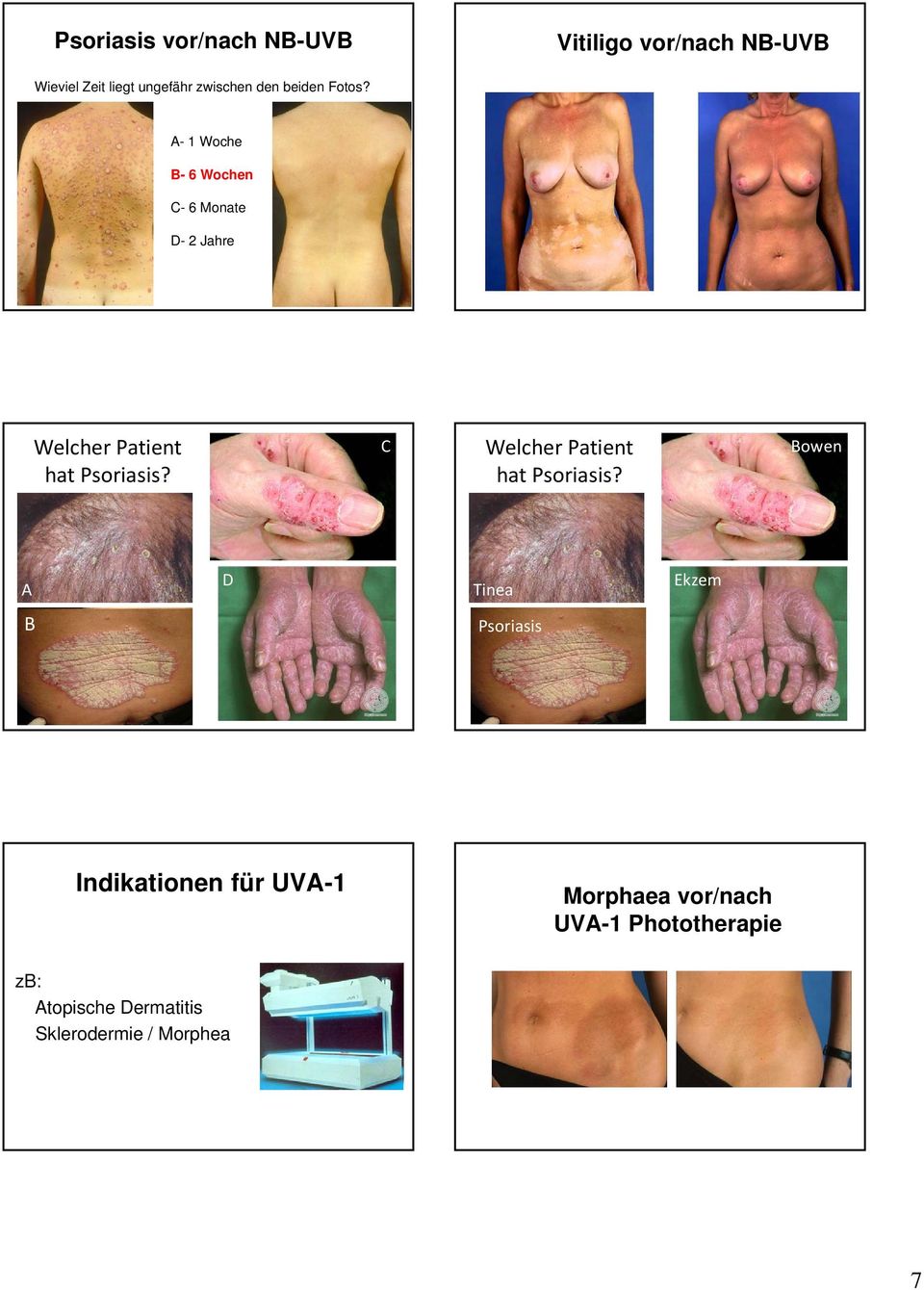 C Welcher Patient hat Psoriasis?