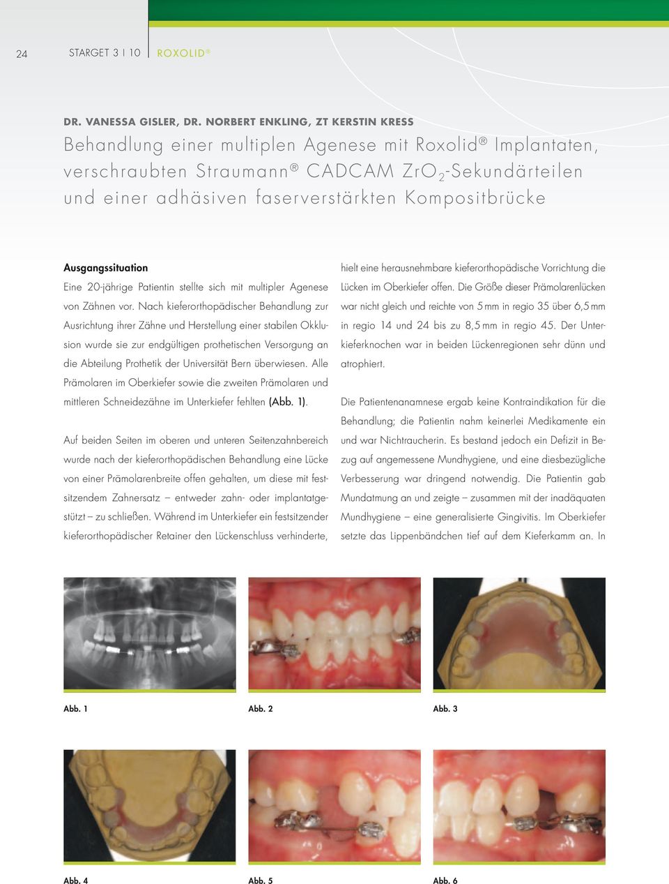 Ausgangssituation Eine 20-jährige Patientin stellte sich mit multipler Agenese von Zähnen vor.