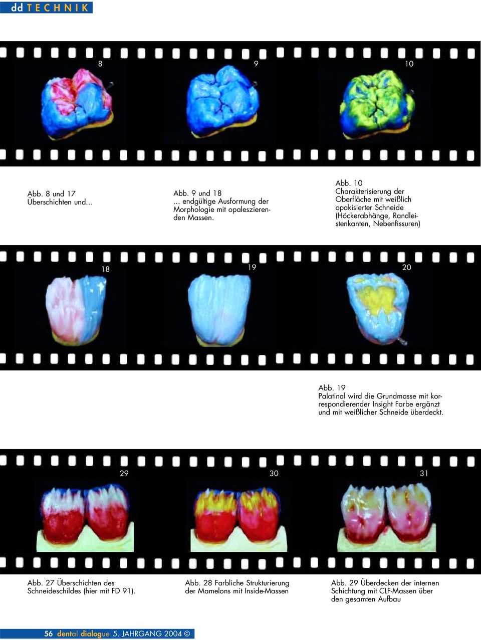 27 Überschichten des Schneideschildes (hier mit FD 91). Abb. 28 Farbliche Strukturierung der Mamelons mit Inside-Massen Abb.