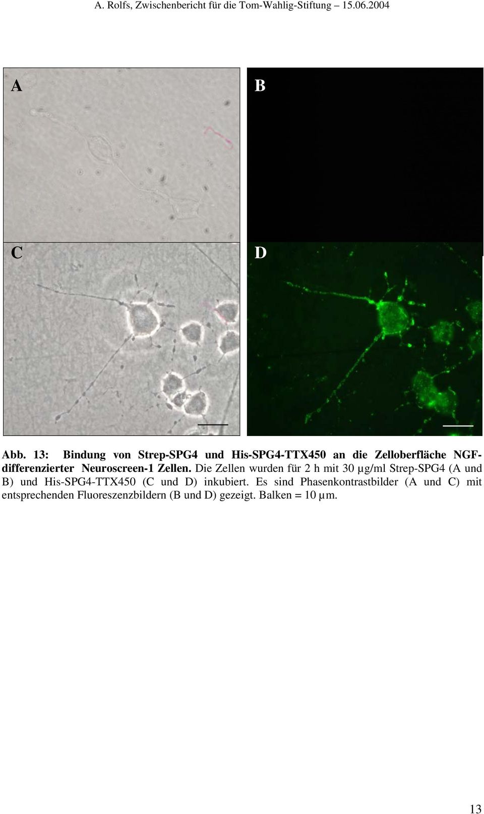 NGFdifferenzierter Neuroscreen-1 Zellen.