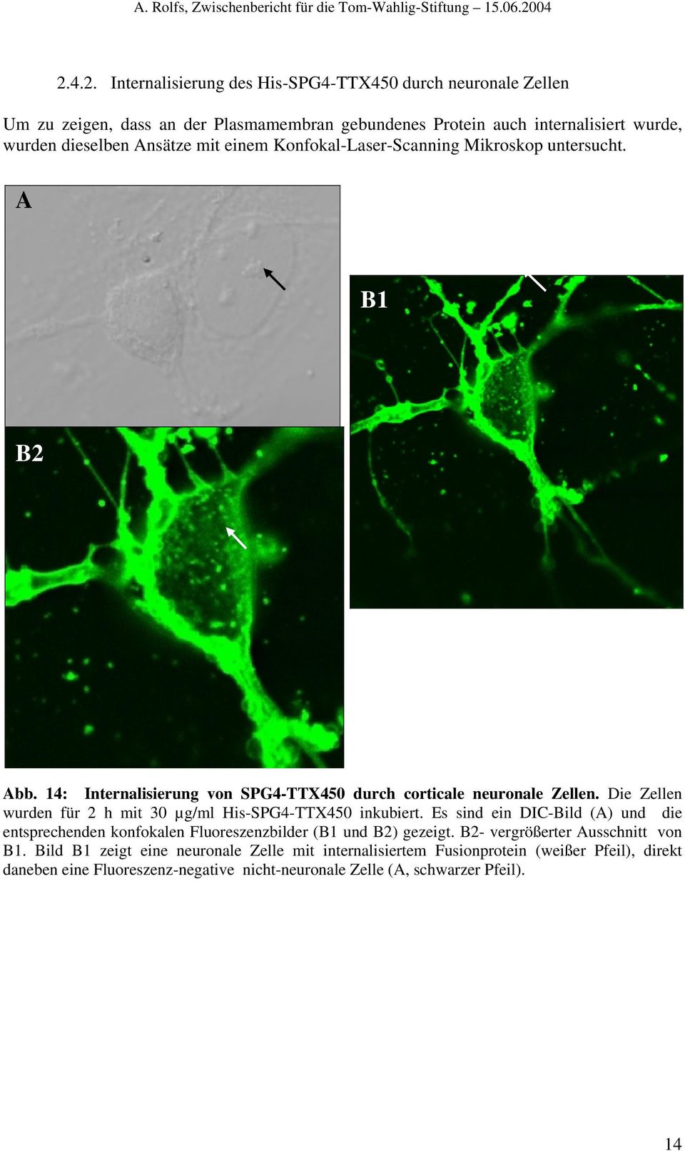 Die Zellen wurden für 2 h mit 30 µg/ml His-SPG4-TTX450 inkubiert. Es sind ein DIC-Bild (A) und die entsprechenden konfokalen Fluoreszenzbilder (B1 und B2) gezeigt.