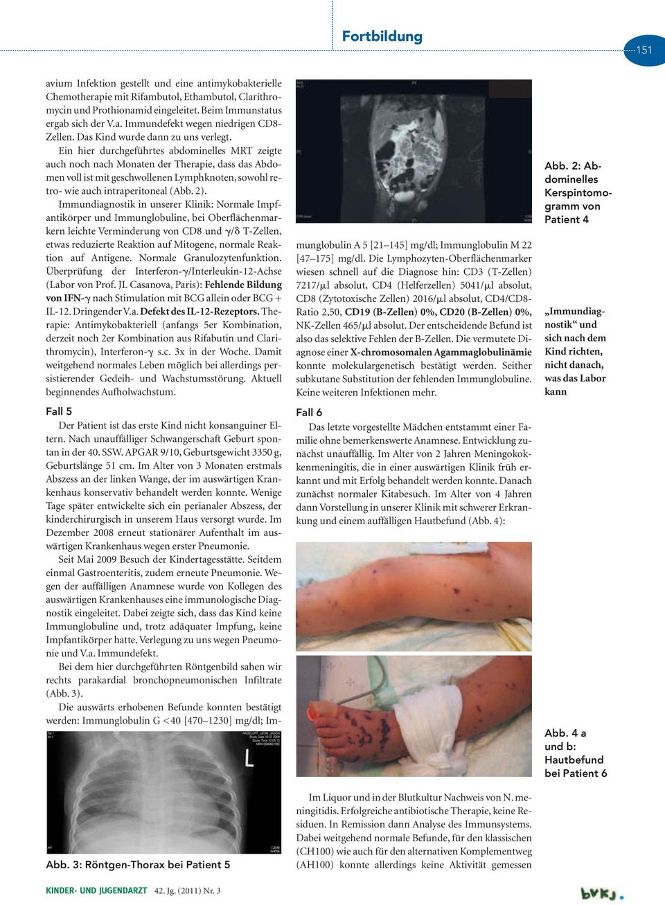 Ein hier durchgeführtes abdominelles MRT zeigte auch noch nach Monaten der Therapie, dass das Abdomen voll ist mit geschwollenen Lymphknoten, sowohl retro- wie auch intraperitoneal (Abb. 2).