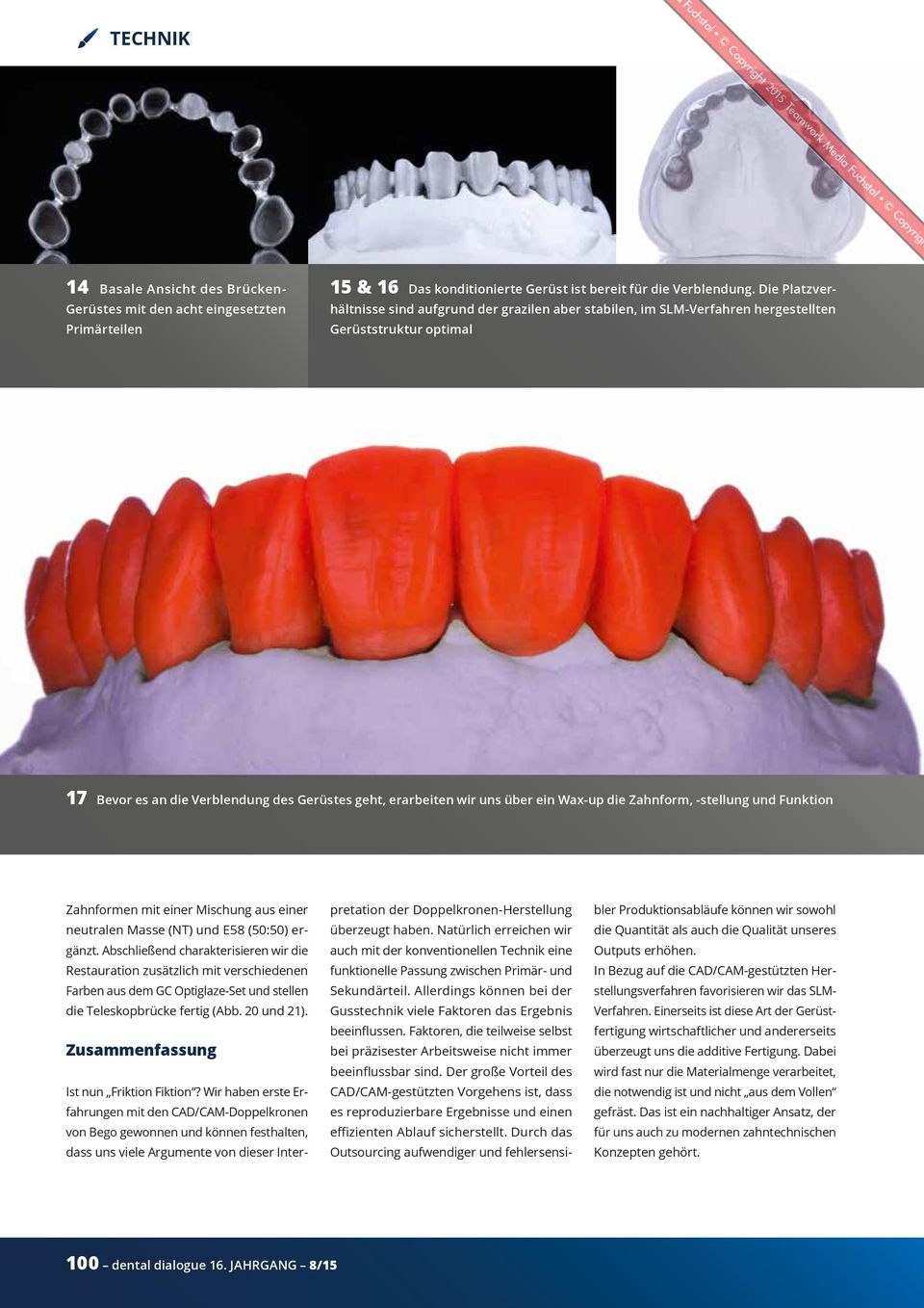 Wax-up die Zahnform, -stellung und Funktion Zahnformen mit einer Mischung aus einer neutralen Masse (NT) und E58 (50:50) ergänzt.