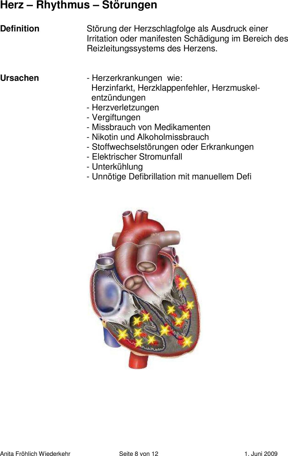 Ursachen - Herzerkrankungen wie: Herzinfarkt, Herzklappenfehler, Herzmuskelentzündungen - Herzverletzungen - Vergiftungen -