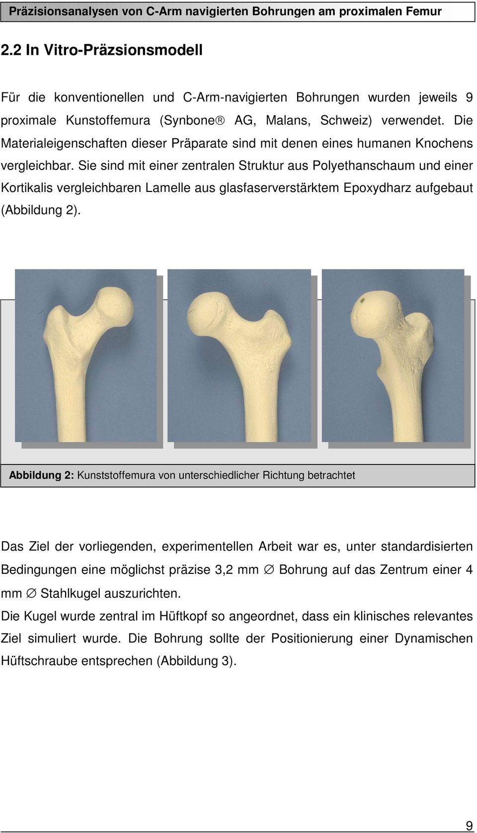 Sie sind mit einer zentralen Struktur aus Polyethanschaum und einer Kortikalis vergleichbaren Lamelle aus glasfaserverstärktem Epoxydharz aufgebaut (Abbildung 2).