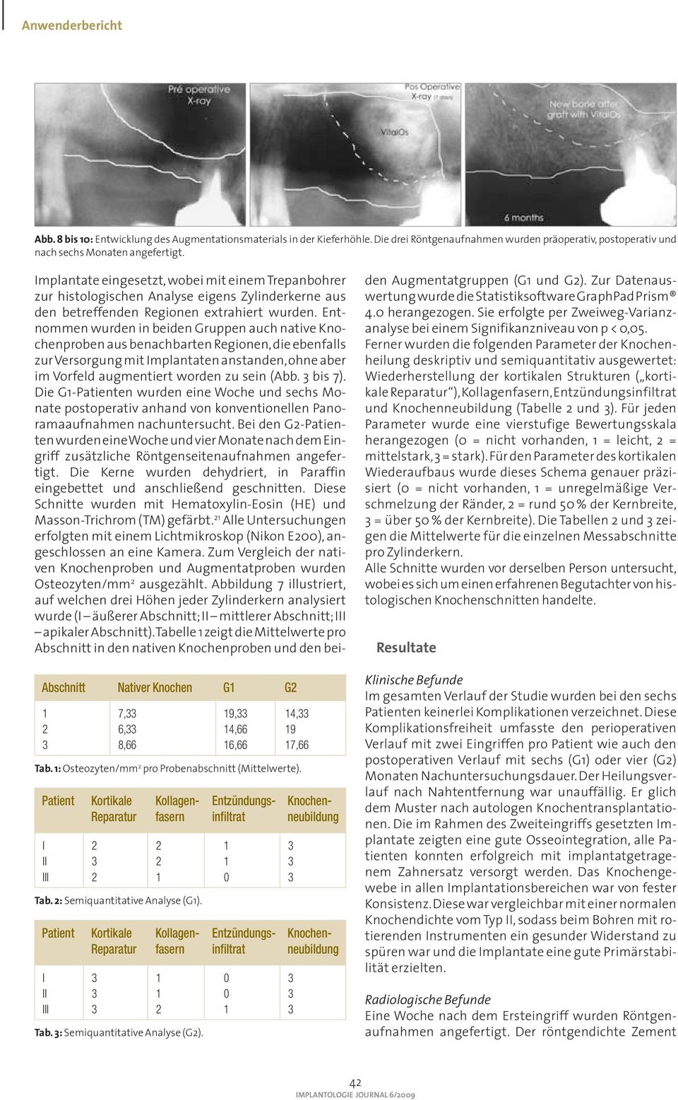 Patient Kortikale Kollagen- Entzündungs- Knochen- Reparatur fasern infiltrat neubildung I 2 2 1 3 II 3 2 1 3 III 2 1 0 3 Tab. 2: Semiquantitative Analyse (G1).