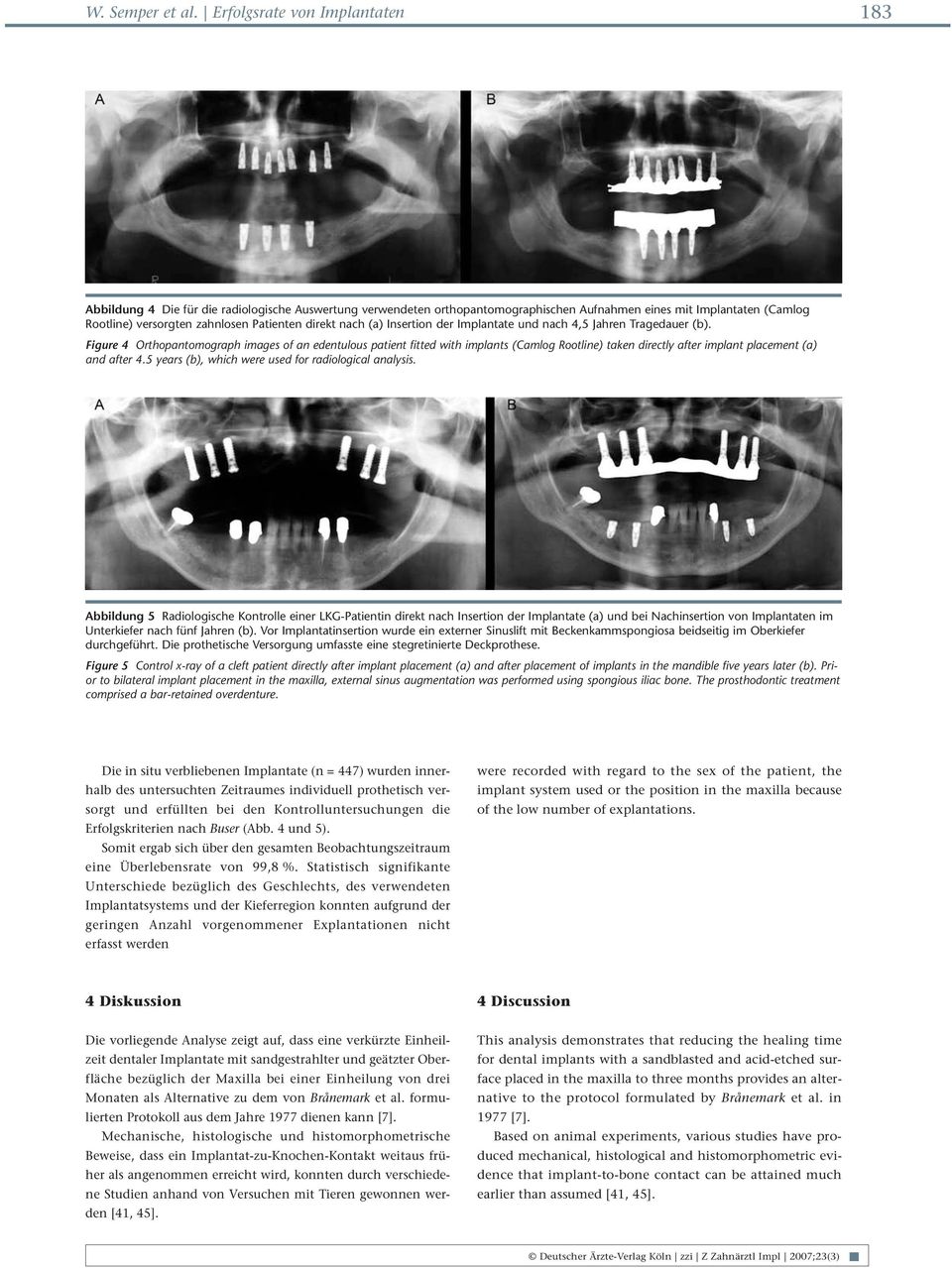 direkt nach (a) Insertion der Implantate und nach 4,5 Jahren Tragedauer (b).