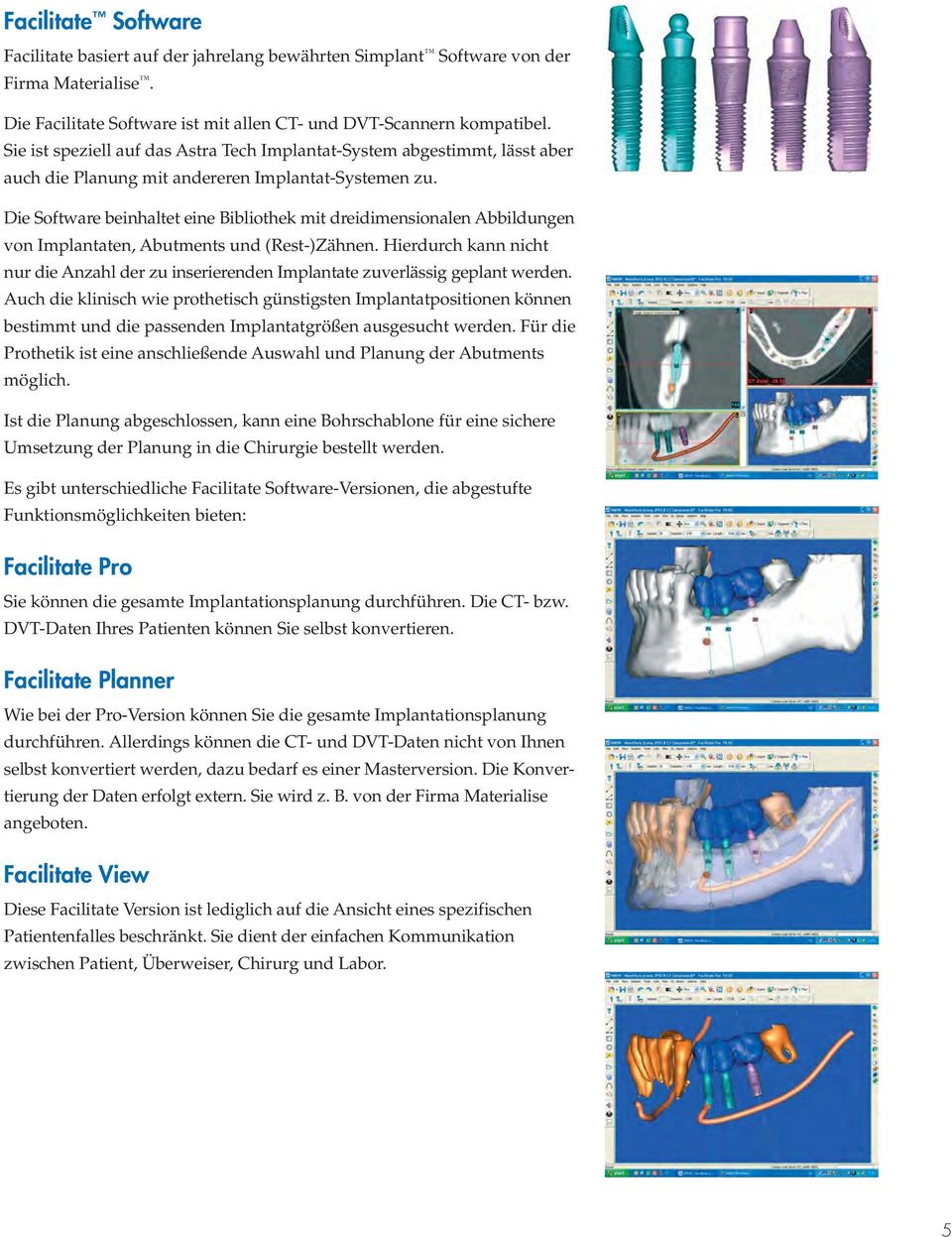 Die Software beinhaltet eine Bibliothek mit dreidimensionalen Abbildungen von Implantaten, Abutments und (Rest-)Zähnen.