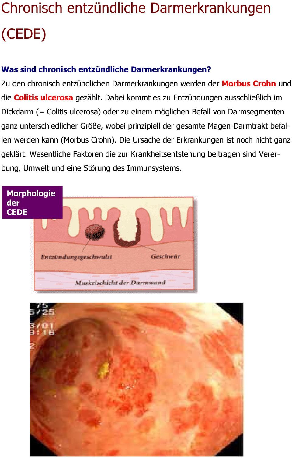 Dabei kommt es zu Entzündungen ausschließlich im Dickdarm (= Colitis ulcerosa) oder zu einem möglichen Befall von Darmsegmenten ganz unterschiedlicher Größe,