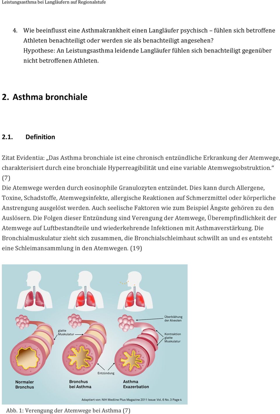 Definition Zitat Evidentia: Das Asthma bronchiale ist eine chronisch entzündliche Erkrankung der Atemwege, charakterisiert durch eine bronchiale Hyperreagibilität und eine variable