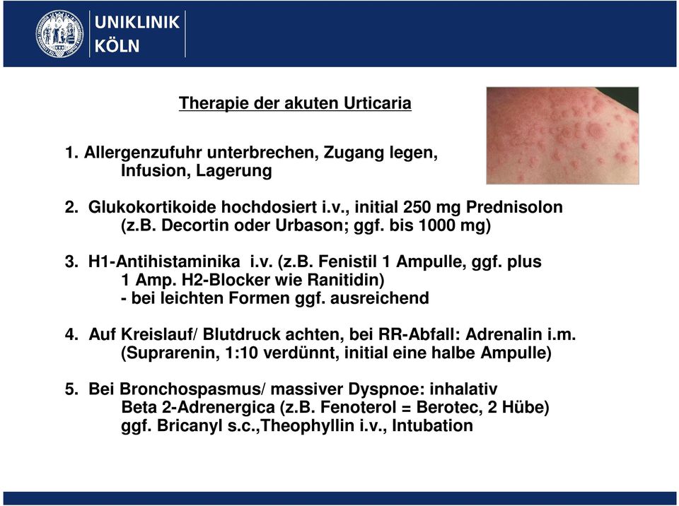 H2-Blocker wie Ranitidin) - bei leichten Formen ggf. ausreichend 4. Auf Kreislauf/ Blutdruck achten, bei RR-Abfall: Adrenalin i.m. (Suprarenin, 1:10 verdünnt, initial eine halbe Ampulle) 5.