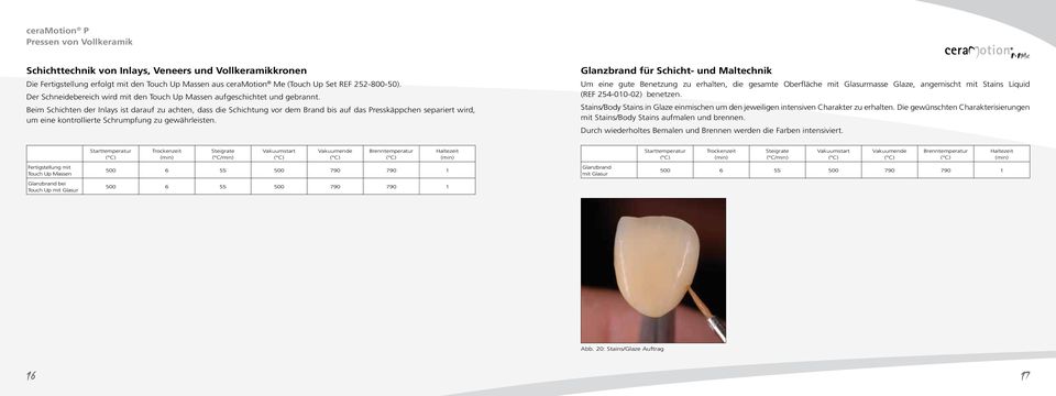 Beim Schichten der Inlays ist darauf zu achten, dass die Schichtung vor dem Brand bis auf das Presskäppchen separiert wird, um eine kontrollierte Schrumpfung zu gewährleisten.