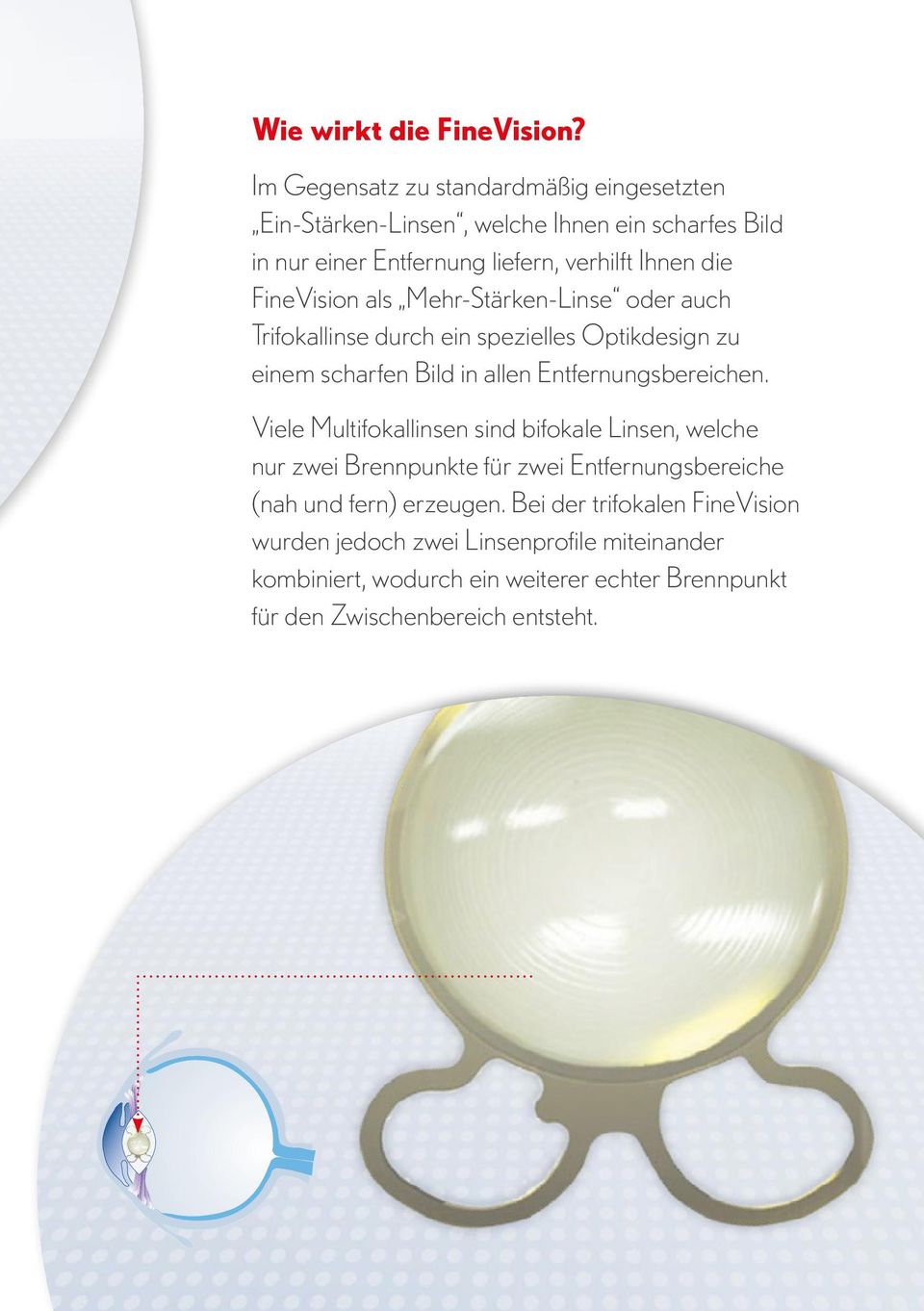 FineVision als Mehr-Stärken-Linse oder auch Trifokallinse durch ein spezielles Optikdesign zu einem scharfen Bild in allen Entfernungsbereichen.