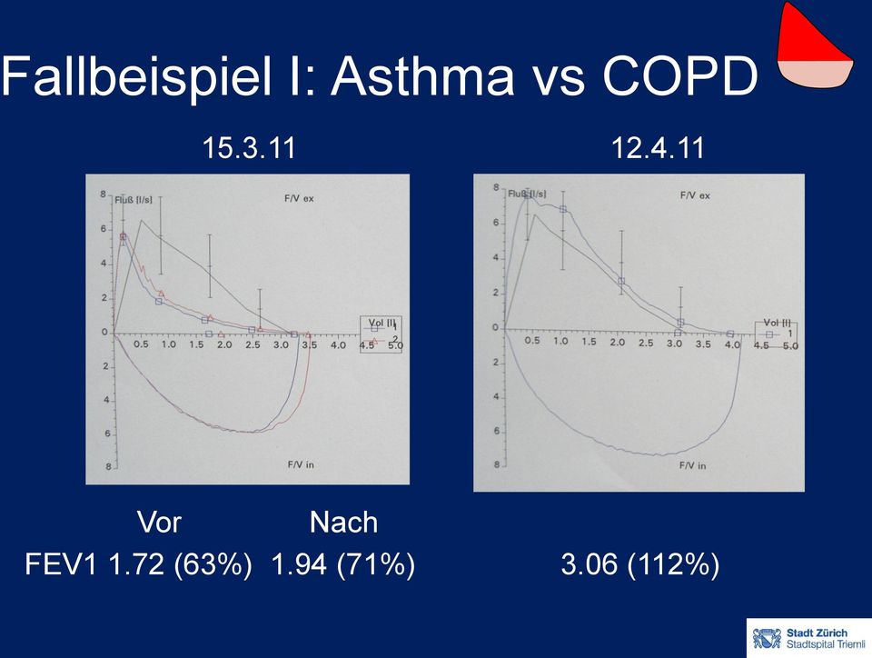11 Vor Nach FEV1 1.