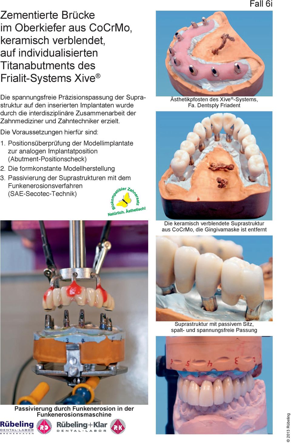Positionsüberprüfung der Modellimplantate zur analogen Implantatposition (Abutment- Positionscheck) 2. Die formkonstante Modellherstellung 3.