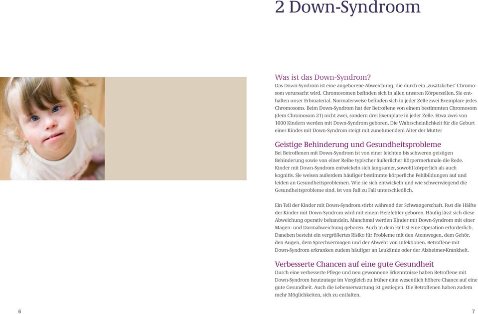 Beim Down-Syndrom hat der Betroffene von einem bestimmten Chromosom (dem Chromosom 21) nicht zwei, sondern drei Exemplare in jeder Zelle. Etwa zwei von 1000 Kindern werden mit Down-Syndrom geboren.