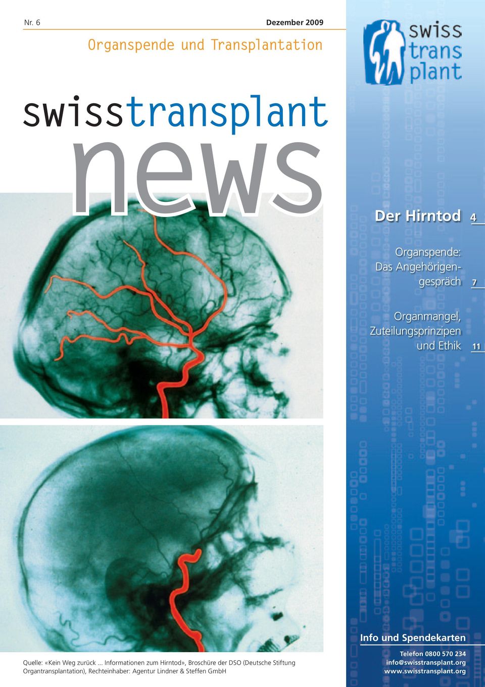 .. Informationen zum Hirntod», Broschüre der DSO (Deutsche Stiftung Organtransplantation),