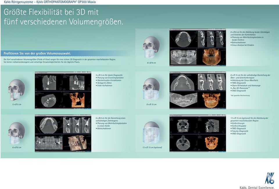 Volumenauswahl. Die fünf verschiedenen Volumengrößen (Fields of View) sorgen für eine sichere 3D Diagnostik in der gesamten maxillofazialen Region.