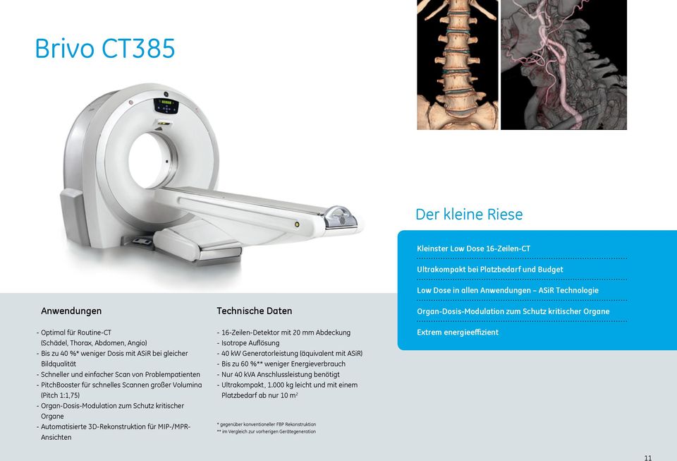 für schnelles Scannen großer Volumina (Pitch 1:1,75) - Organ-Dosis-Modulation zum Schutz kritischer Organe - Automatisierte 3D-Rekonstruktion für MIP-/MPR- Ansichten - 16-Zeilen-Detektor mit 20 mm