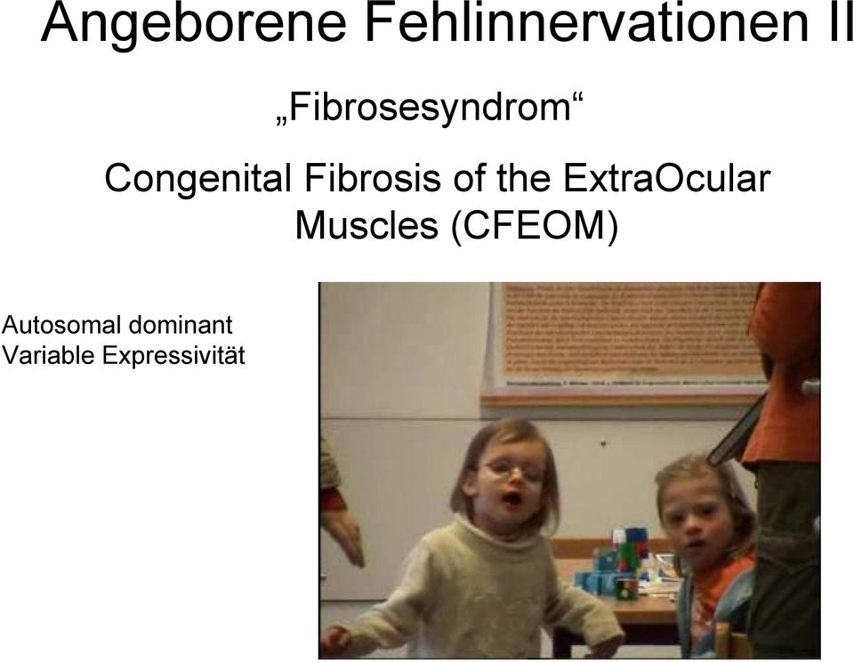 of the ExtraOcular Muscles (CFEOM)