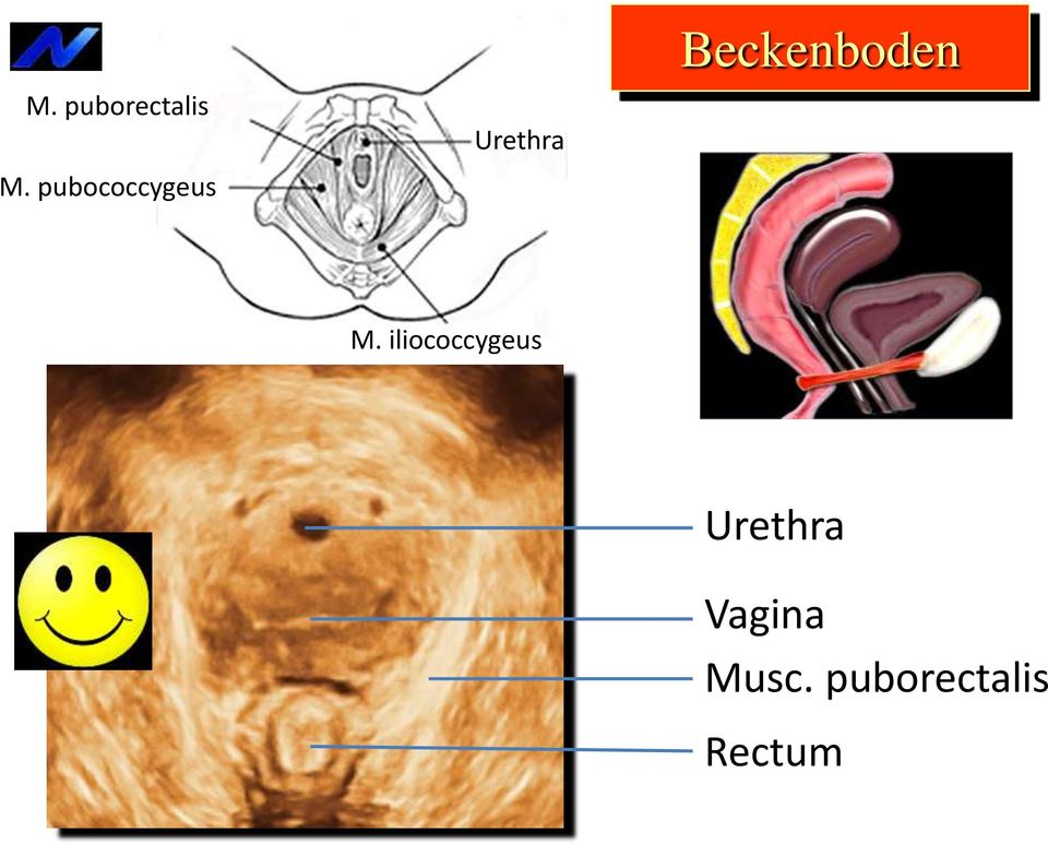 pubococcygeus Urethra M.