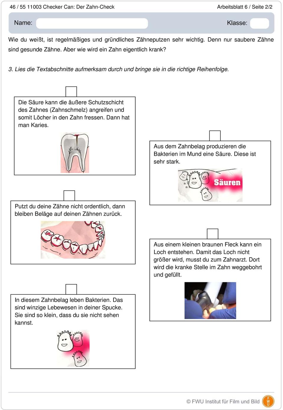Die Säure kann die äußere Schutzschicht des Zahnes (Zahnschmelz) angreifen und somit Löcher in den Zahn fressen. Dann hat man Karies. Aus dem Zahnbelag produzieren die Bakterien im Mund eine Säure.