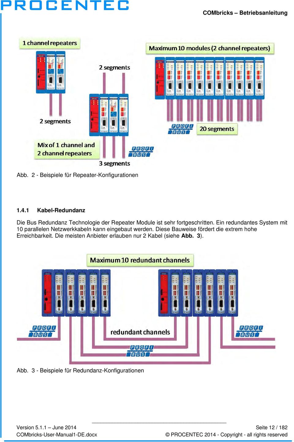 Ein redundantes System mit 10 parallelen Netzwerkkabeln kann eingebaut werden.