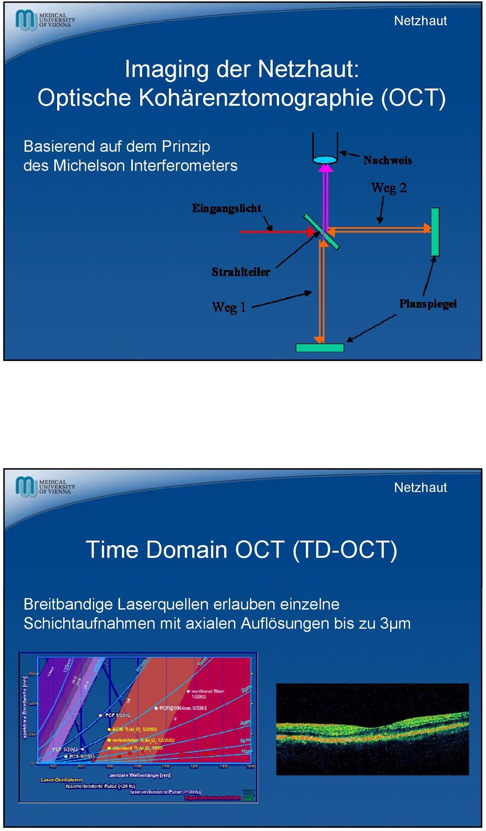 Netzhaut Time Domain OCT (TD-OCT) Breitbandige Laserquellen