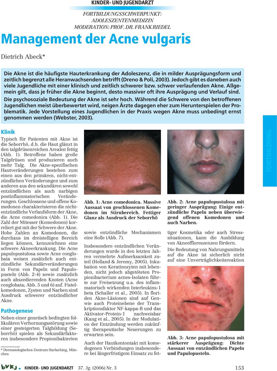 (Dreno & Poli, 2003). Jedoch gibt es daneben auch viele Jugendliche mit einer klinisch und zeitlich schwerer bzw. schwer verlaufenden Akne.