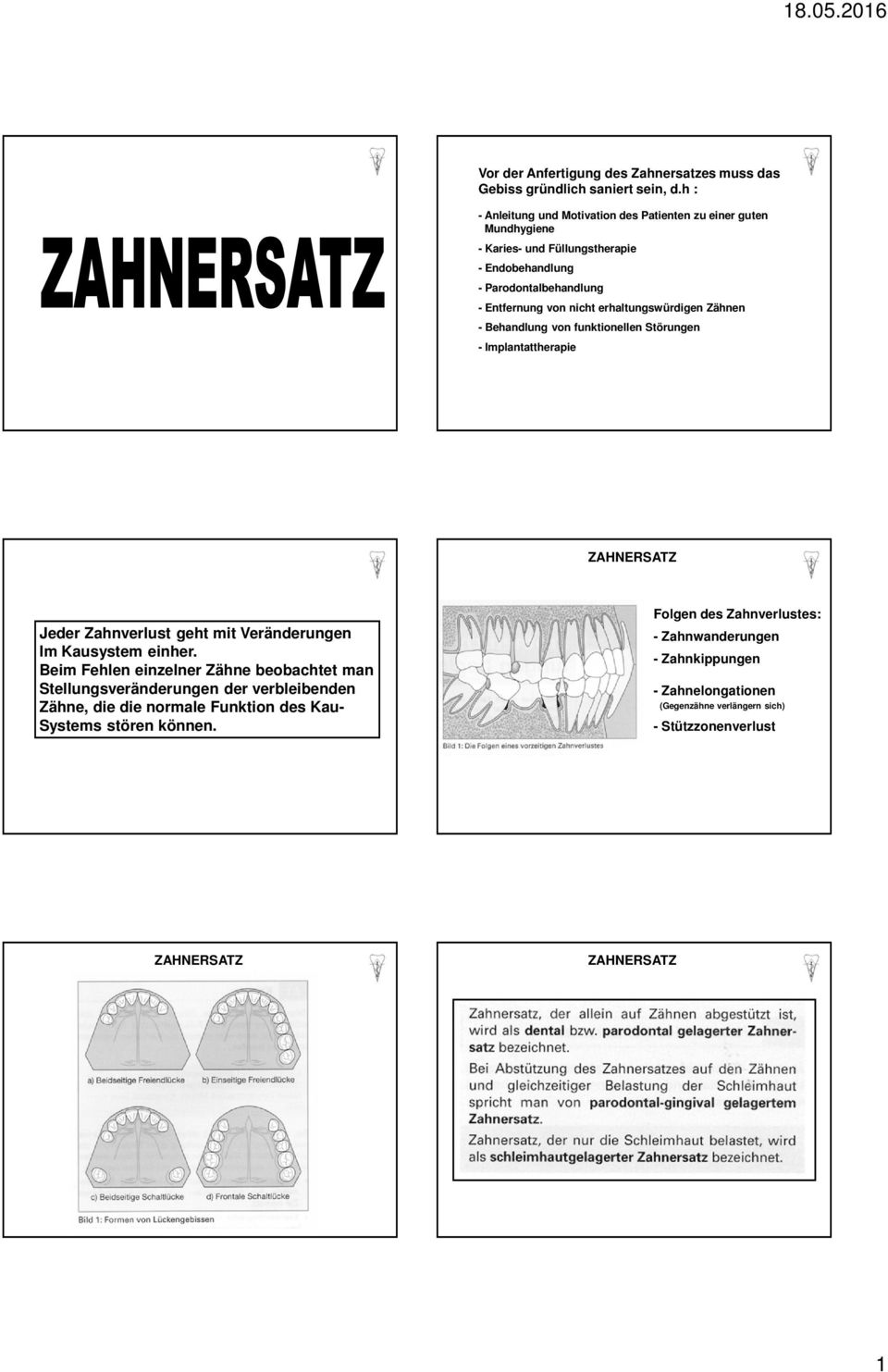 erhaltungswürdigen Zähnen - Behandlung von funktionellen Störungen - Implantattherapie Jeder Zahnverlust geht mit Veränderungen Im Kausystem einher.