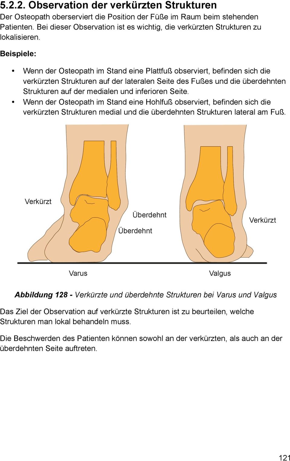 Beispiele: Wenn der Osteopath im Stand eine Plattfuß observiert, befinden sich die verkürzten Strukturen auf der lateralen Seite des Fußes und die überdehnten Strukturen auf der medialen und