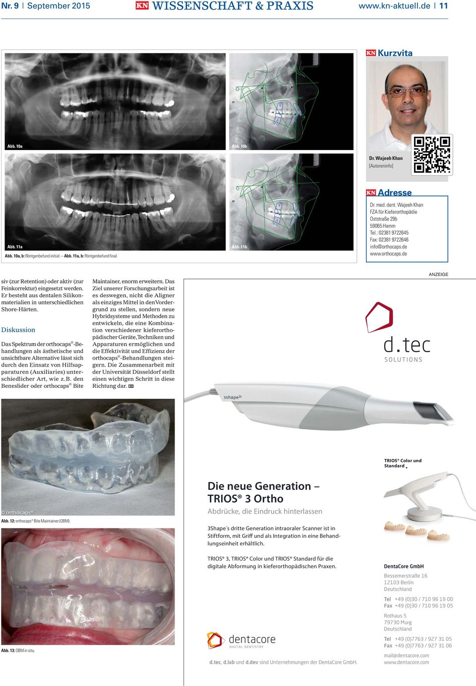 de www.orthocaps.de siv (zur Retention) oder aktiv (zur Feinkorrektur) eingesetzt werden. Er besteht aus dentalen Silikonmaterialien in unterschiedlichen Shore-Härten.