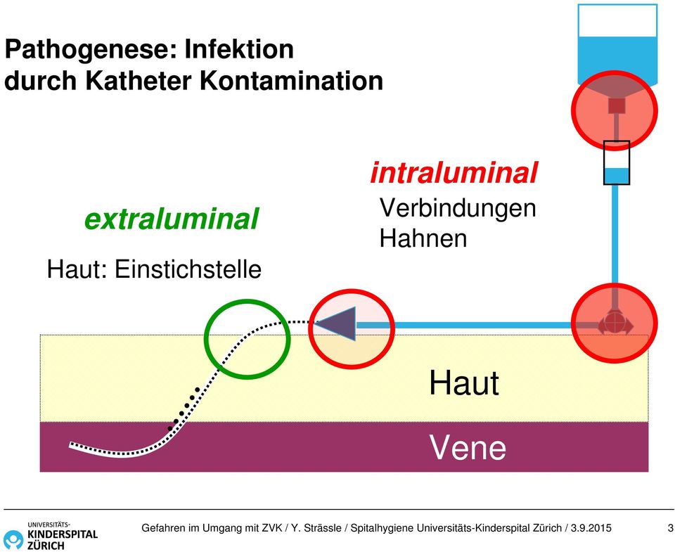 extraluminal Haut: