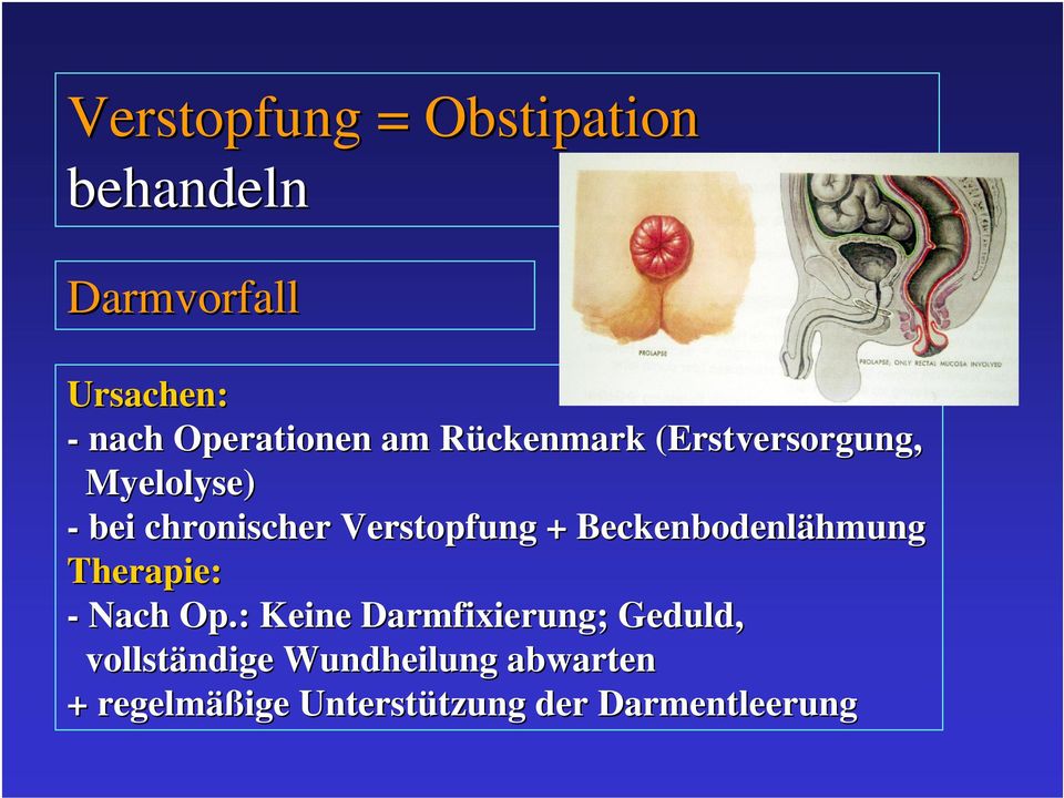 Beckenbodenlähmung Therapie: - Nach Op.