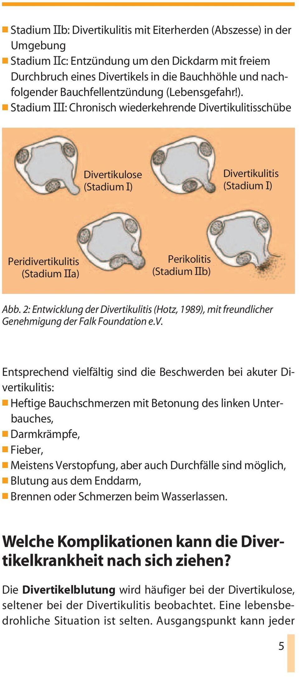 Stadium III: Chronisch wiederkehrende Divertikulitisschübe Divertikulose (Stadium I) Divertikulitis (Stadium I) Peridivertikulitis (Stadium IIa) Perikolitis (Stadium IIb) Abb.