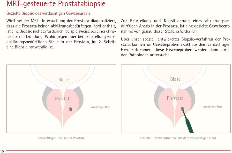 Schritt eine Biopsie notwendig ist. Zur Beurteilung und Klassifizierung eines abklärungsbedürftigen Areals in der Prostata, ist eine gezielte Gewebeentnahme von genau dieser Stelle erforderlich.