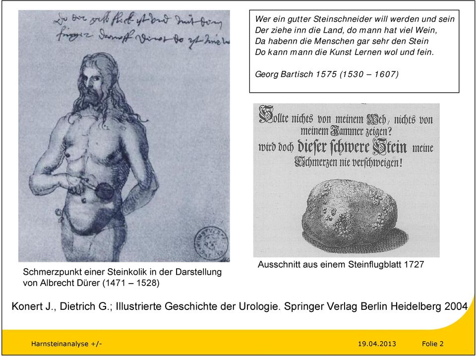 Georg Bartisch 1575 (1530 1607) Schmerzpunkt einer Steinkolik in der Darstellung von Albrecht Dürer (1471 1528)